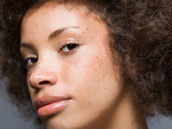 Black Girls with Freckles