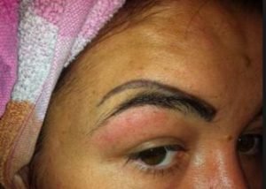 Botched tattooed eyebrows