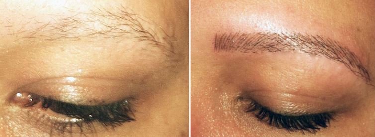 Cosmetic brow tattooing