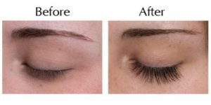 Eyelash Extensions Guide – Before and After Looks with Eyelash Extensions