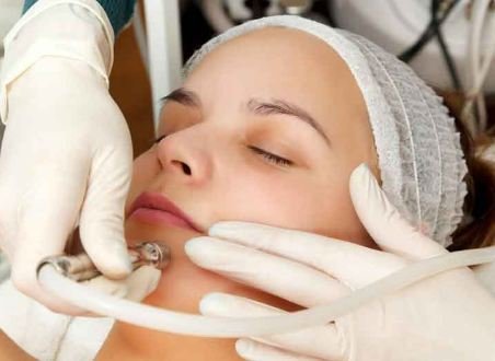 How to Whiten Skin Fast - Laser Skin Whitening