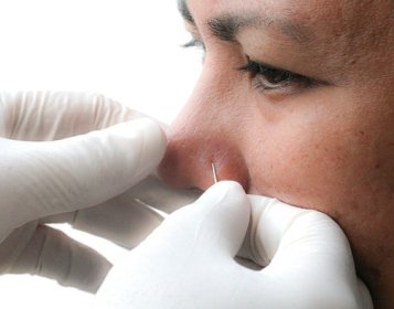 Nose Piercing Care, Aftercare and Healing - How to Care for Nose Piercing