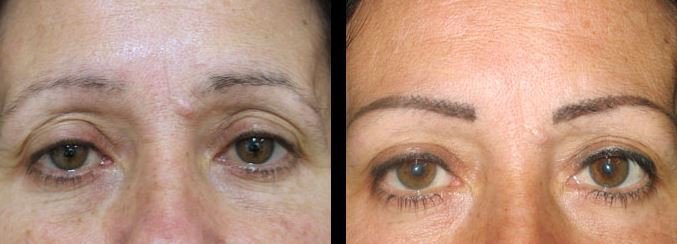 Permanent eyebrows before and after three weeks