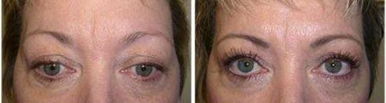 Soft Fill Technique for permanent eyebrows