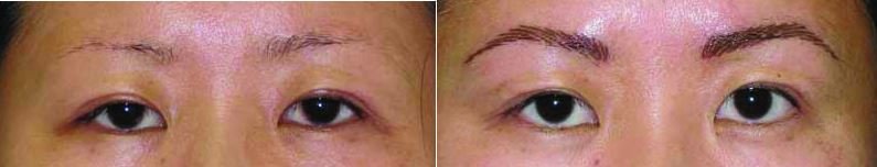 Tattooed eyebrows pictures - Before and after feather stroke