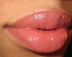 What Is a Lip Plumper - Lip Plumper – Best Reviews, Natural, Homemade, Plumping Lip Gloss, Fusion, Collagen, How to Make, Before and After -Peach Lip Plumper
